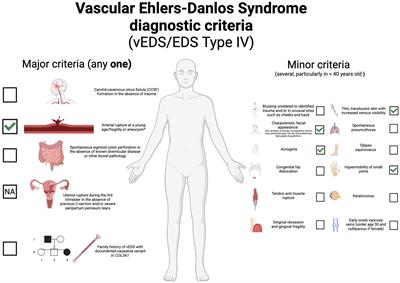 Case report: A novel COL3A1 variant in a Colombian patient with isolated cerebrovascular involvement in vascular Ehlers–Danlos syndrome